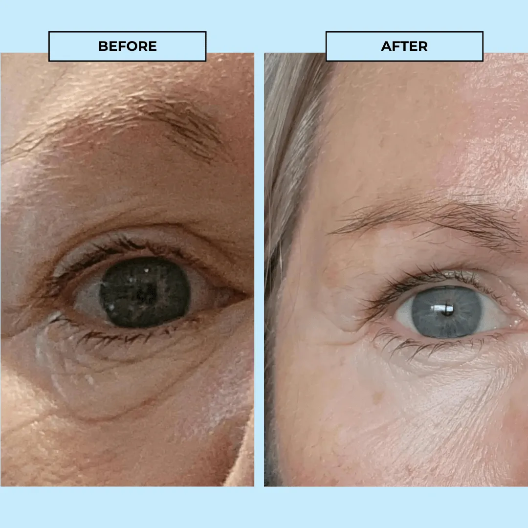Eye Reset Serum